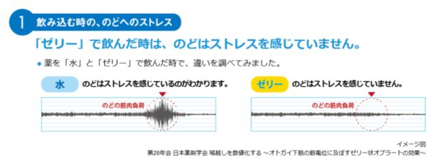 のどのストレス